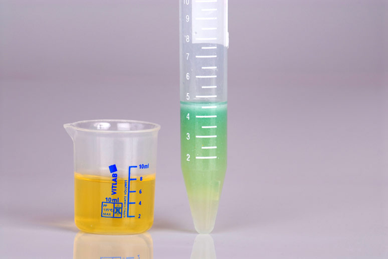 Heavy Metal Screening Urine test no metals